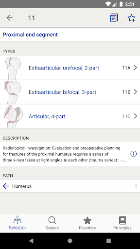 AOOTA Fracture Classification mod screenshots 2
