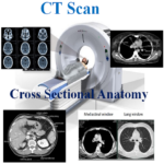 CT Scan Cross Sectional Anatomy MOD