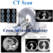 CT Scan Cross Sectional Anatomy MOD