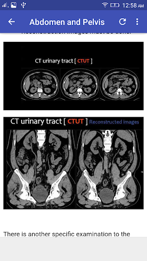 CT Scan Cross Sectional Anatomy mod screenshots 5
