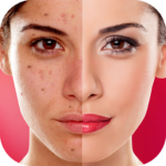 Face Blemishes Cleaner & Photo Scars Remover MOD