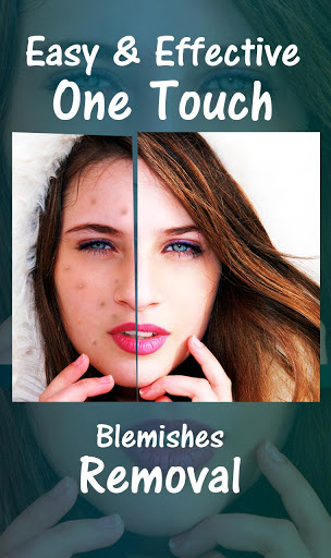 Face Blemishes Cleaner amp Photo Scars Remover mod screenshots 1