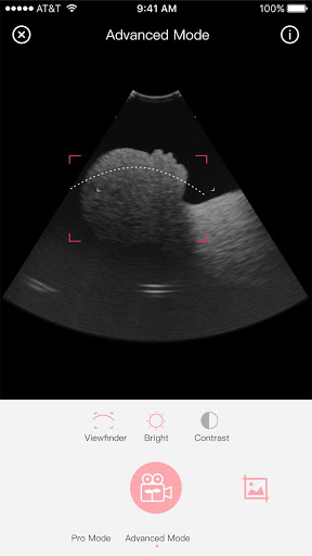 MARVOTO Fetus Camera mod screenshots 2