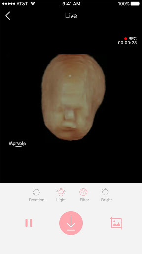 MARVOTO Fetus Camera mod screenshots 3