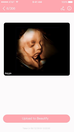 MARVOTO Fetus Camera mod screenshots 5
