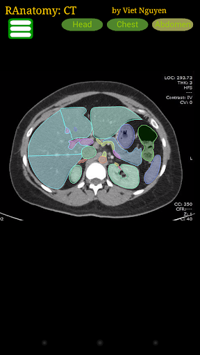 Radiology CT Anatomy mod screenshots 1