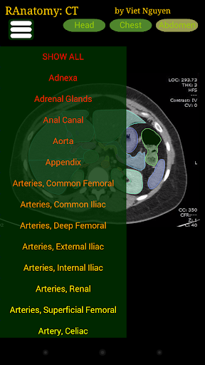 Radiology CT Anatomy mod screenshots 2