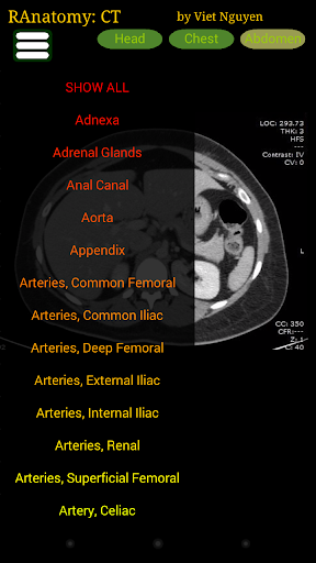 Radiology CT Anatomy mod screenshots 3