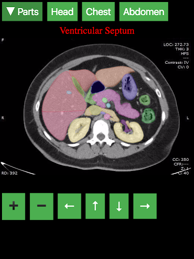 Radiology CT Anatomy mod screenshots 5